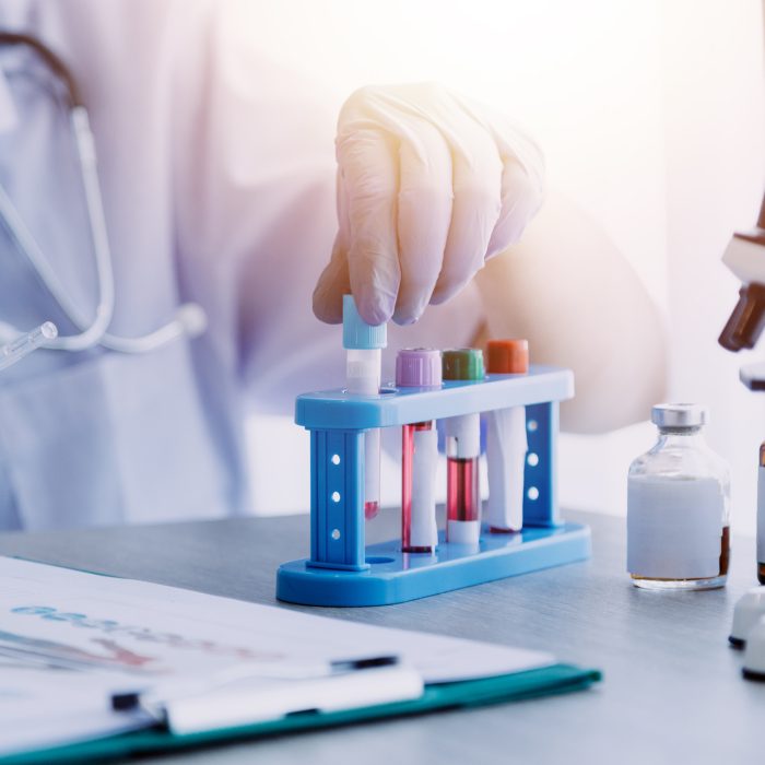 biochemical research scientist team working with microscope for coronavirus vaccine development in pharmaceutical research labolatory, selective focus